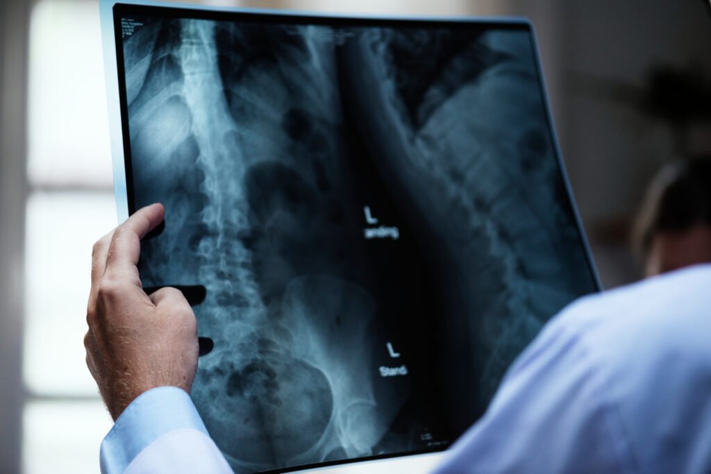best spine surgeon in Athens