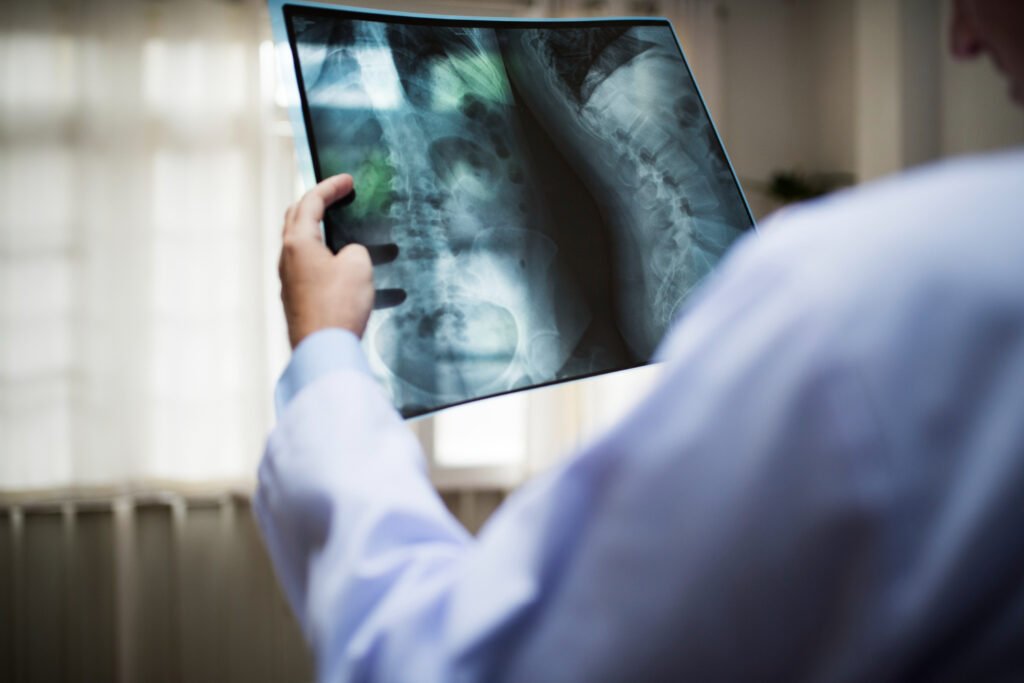 spine surgery in Athens