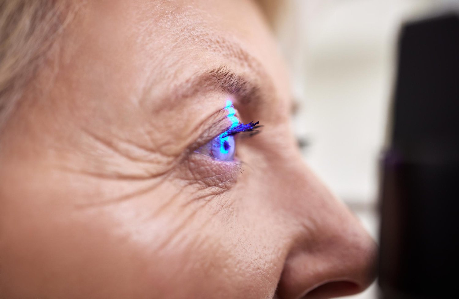 best ophthalmologists for myopia laser surgery in Athens
