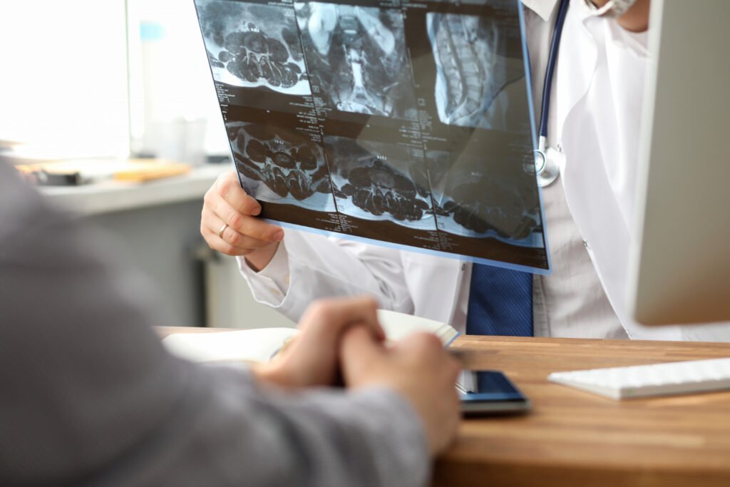 best spine neurosurgeons in Athens