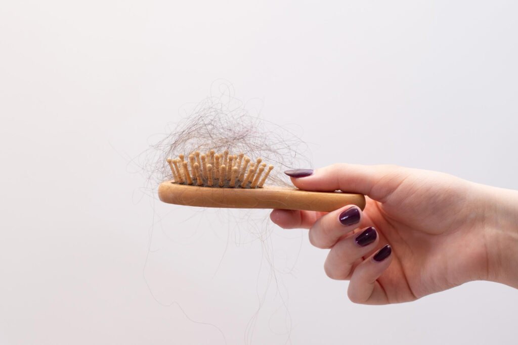 postpartum hair loss